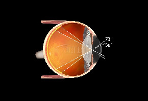 Volk Pan Retinal 2.2 - schwarz / mit individueller Gravur