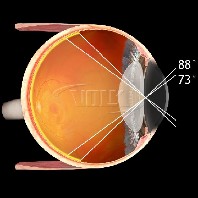 Volk ind. vitreo Kontaktglas Central Retinal Standard oder SSV