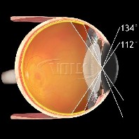 Volk ind. vitreo Kontaktglas Mini Quad XL - SSV oder Standard Kontaktfläche