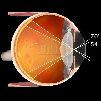 Volk Einweg Ophthalmoskopierlupe  28D - 10 Stück